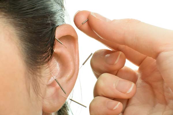 traitement acupuncture de l’oreille