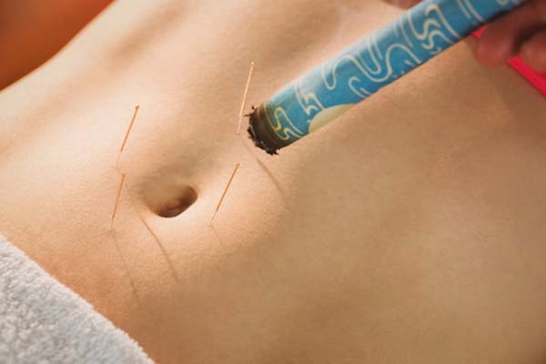 acupuncture treatment stomach